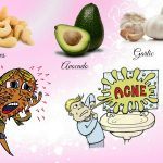 foods for acne